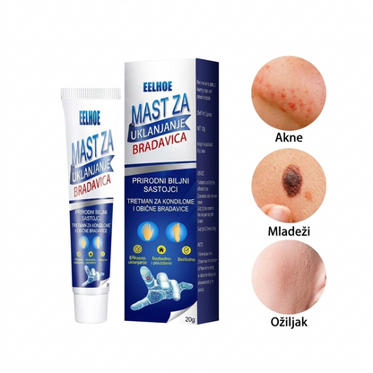 MAGIČNA Krema protiv Bradavica i Mladeža [1+1 GRATIS]