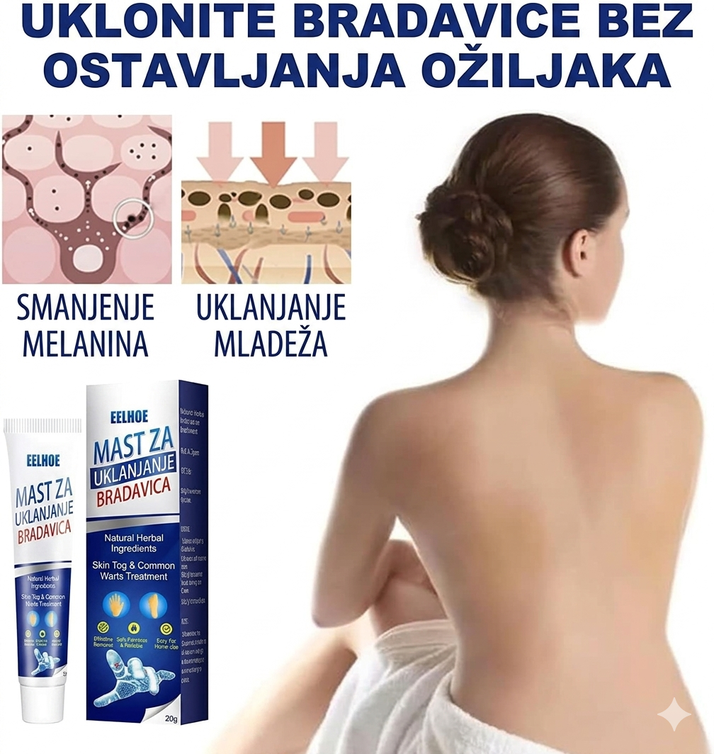 MAGIČNA Krema protiv Bradavica i Mladeža [1+1 GRATIS]