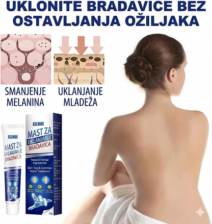 MAGIČNA Krema protiv Bradavica i Mladeža [1+1 GRATIS]